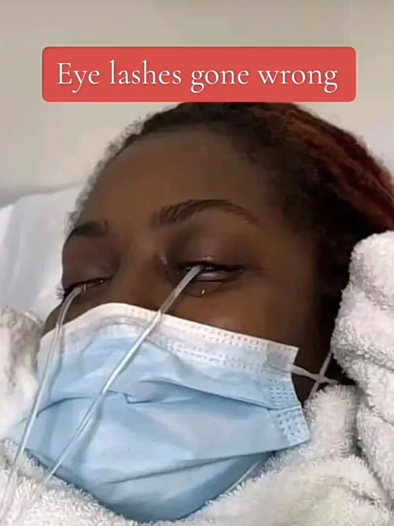 “They had to flush her eyes out 4 times” — Lady nearly goes blind as she fixes lashes 