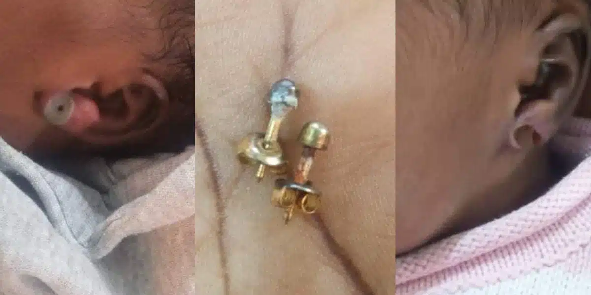 New born nearly loses ear after her mom pierced it when she was only one week old